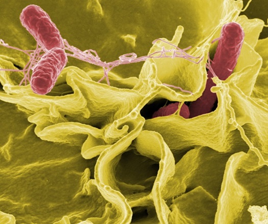 Imagen: Micrografía electrónica de barrido mejorada por color que muestra Salmonella typhimurium (rojo) invadiendo células humanas cultivadas (foto cortesía de Rocky Mountain Laboratories, NIAID, NIH)